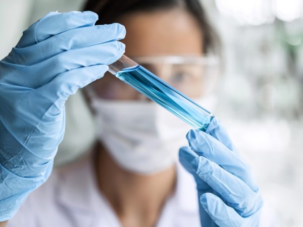 scientist-or-medical-in-lab-coat-holding-test-tube-with-reagent-laboratory-glassware-containing_t20_ynL6KL